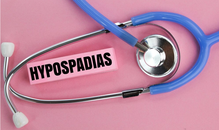 How to Prepare Your Child for Hypospadias Surgery